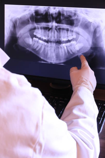 Best Emergency Dental Extractions in Olympia, WA